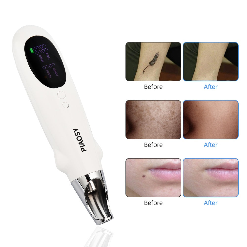 9+9 Rechargeable Laser Picosecond Pen For Removing Acne Marks And Moles Pens For Household Eyebrow Washes And Tattoos For Removing Pigmented Acne Pens