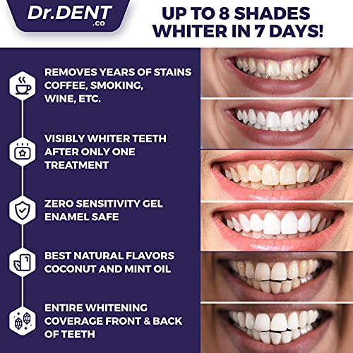 DrDent Premium Teeth Whitening Strips - 20 Whitening Sessions - Non-Sensitive Formula - 40 Peroxide Free Whitening Strips - Safe for Enamel + Mouth Opener Included